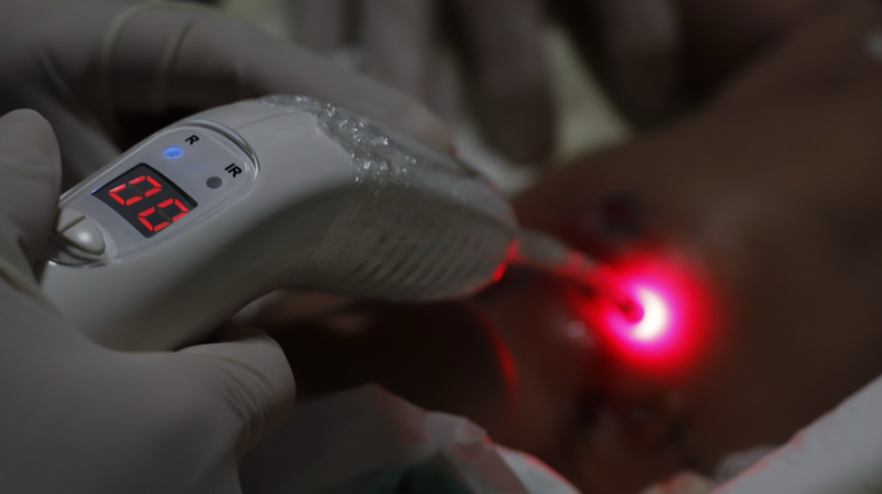 Aplicação de laserterapia durante o cuidado de ferida